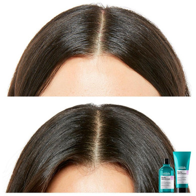 Scalp Advanced Champú Recarga 500 Ml