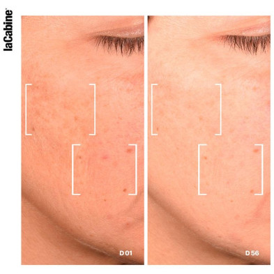 25% Niacinamide Pro Complex Advanced Serum 30 Ml