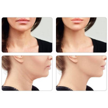 Antiedad Rostro Y Cuello Dispositivo 1 U