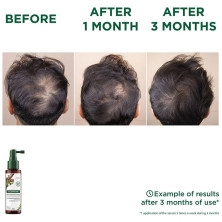 A La Quinina Y Edelweiss Bio Serum Anticaída 100 Ml