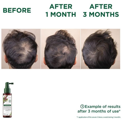 A La Quinina Y Edelweiss Bio Serum Anticaída 100 Ml