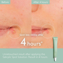 Vinopure Salicylic Spot Solution 15 Ml