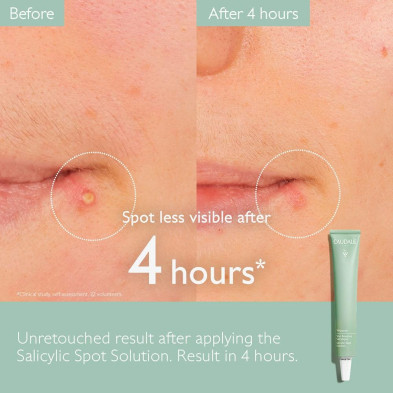 Vinopure Salicylic Spot Solution 15 Ml