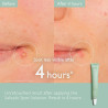 Vinopure Salicylic Spot Solution 15 Ml