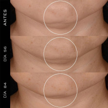 Lancôme Rénergie H.P.N. 300 Peptide Cream Recharge 50Ml