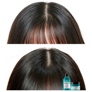 L'Oréal Scalp Advanced Anti-Oiliness Dermo-Purifier Shampoo 500Ml