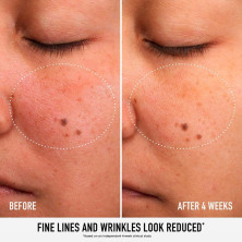 Skin Rescue Pure Smooth Serum Sérum Corrector De Líneas Y Arrugas 30 Ml