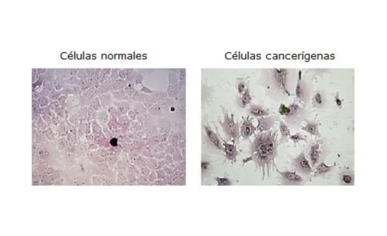 Propiedades anticancerígenas del kéfir